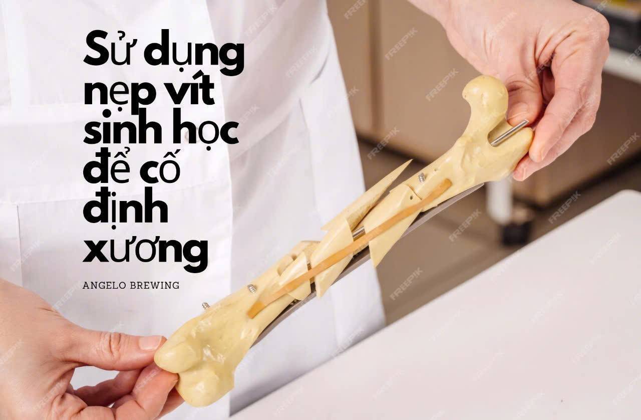 Chăm sóc và điều trị gãy xương chân của Nguyễn Xuân Son: Góc nhìn từ chuyên gia