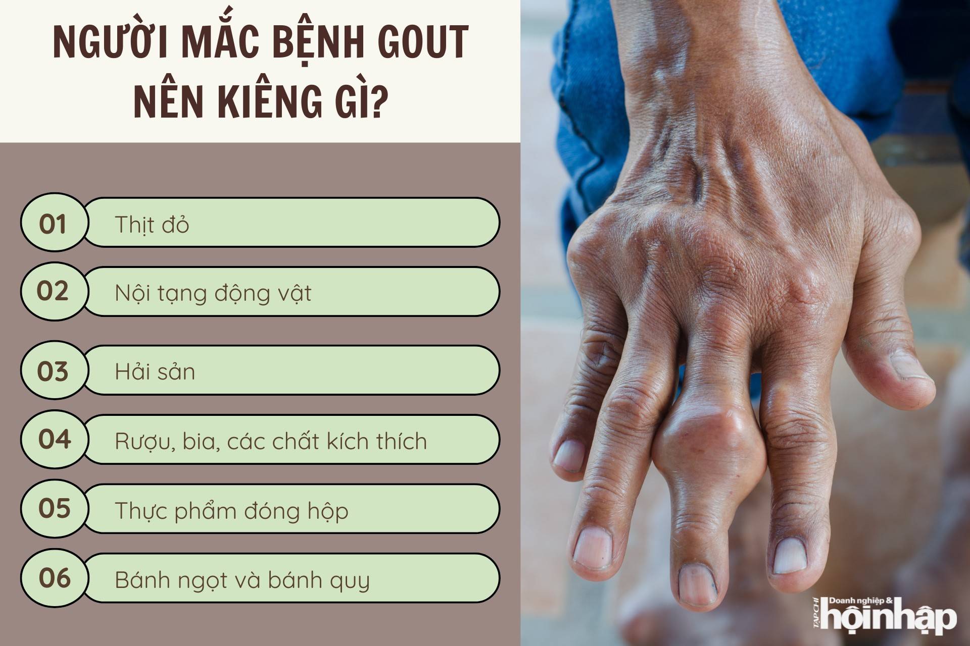 Người mắc bệnh gout nên kiêng gì?