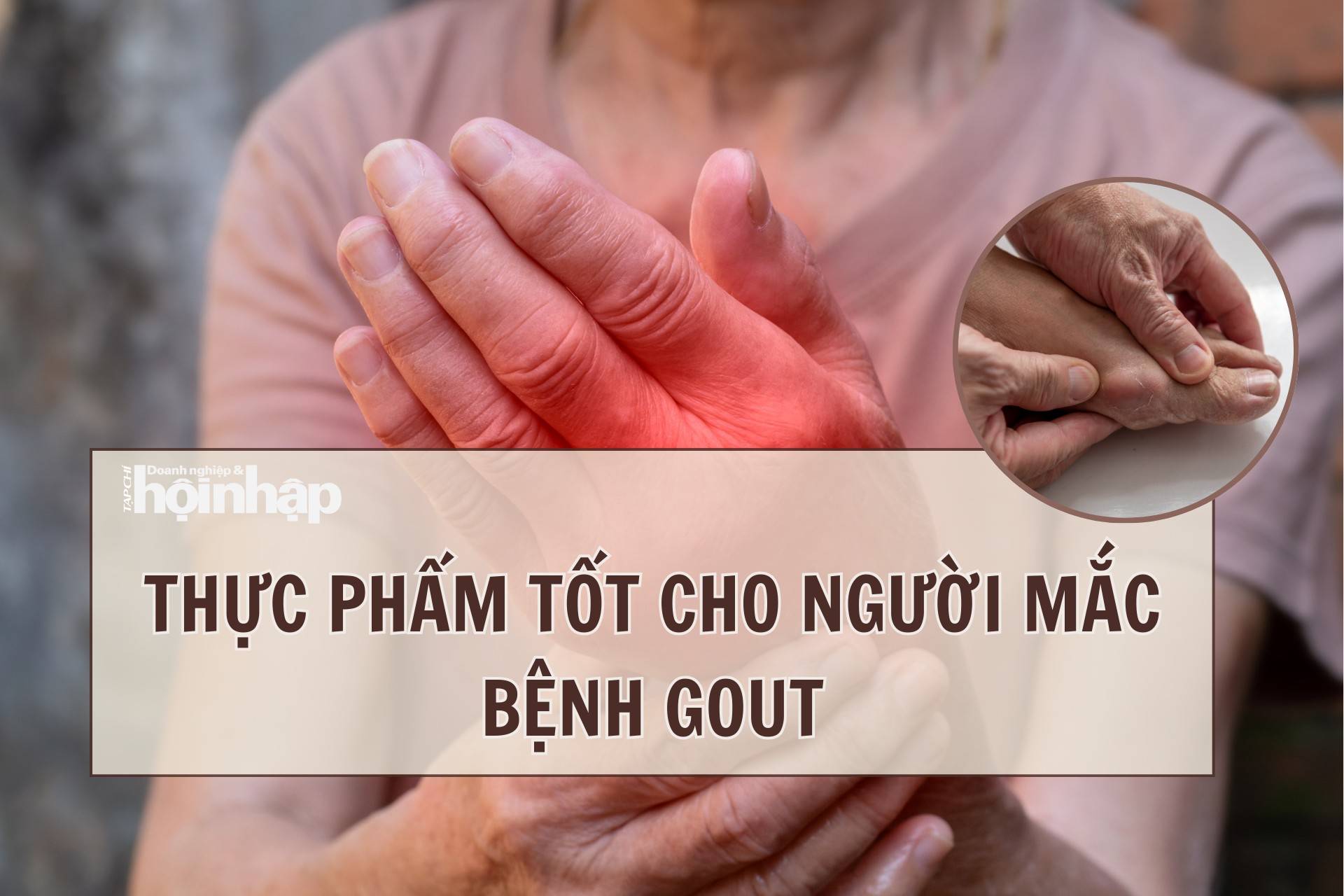 Thực phẩm tốt cho người mắc bệnh gout
