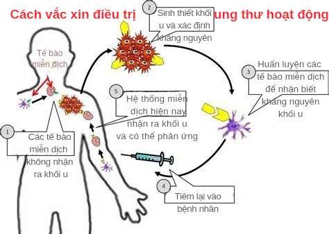Vắc xin điều trị ung thư: Tin vui y học cho mọi người