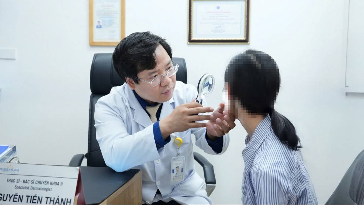 Tổn thương da nghiêm trọng vì dùng chanh tươi trị mụn