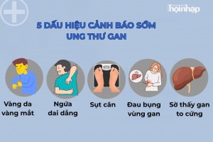 Ung thư gan: Những dấu hiệu ban đầu bạn nên biết để phòng ngừa kịp thời