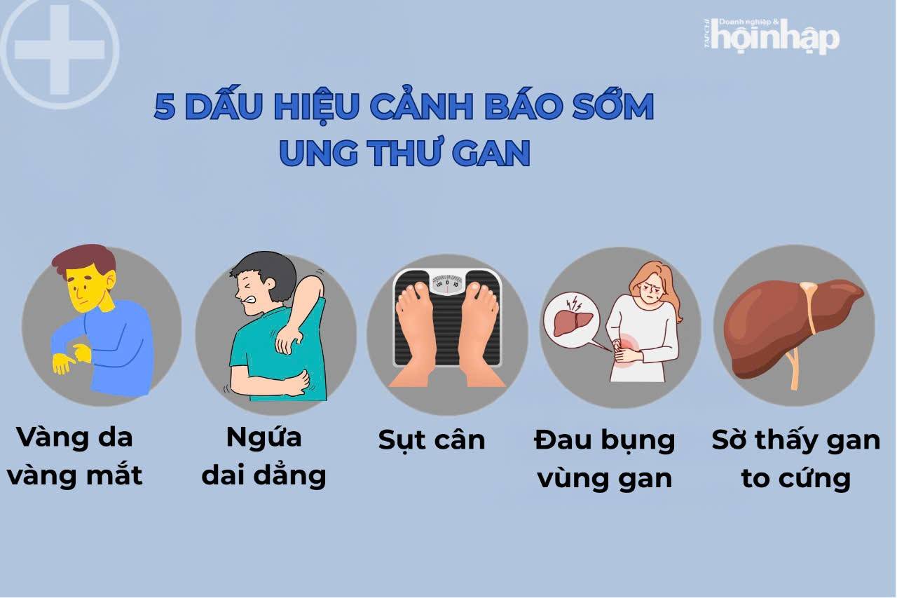 Ung thư gan: Những dấu hiệu ban đầu bạn nên biết để phòng ngừa kịp thời