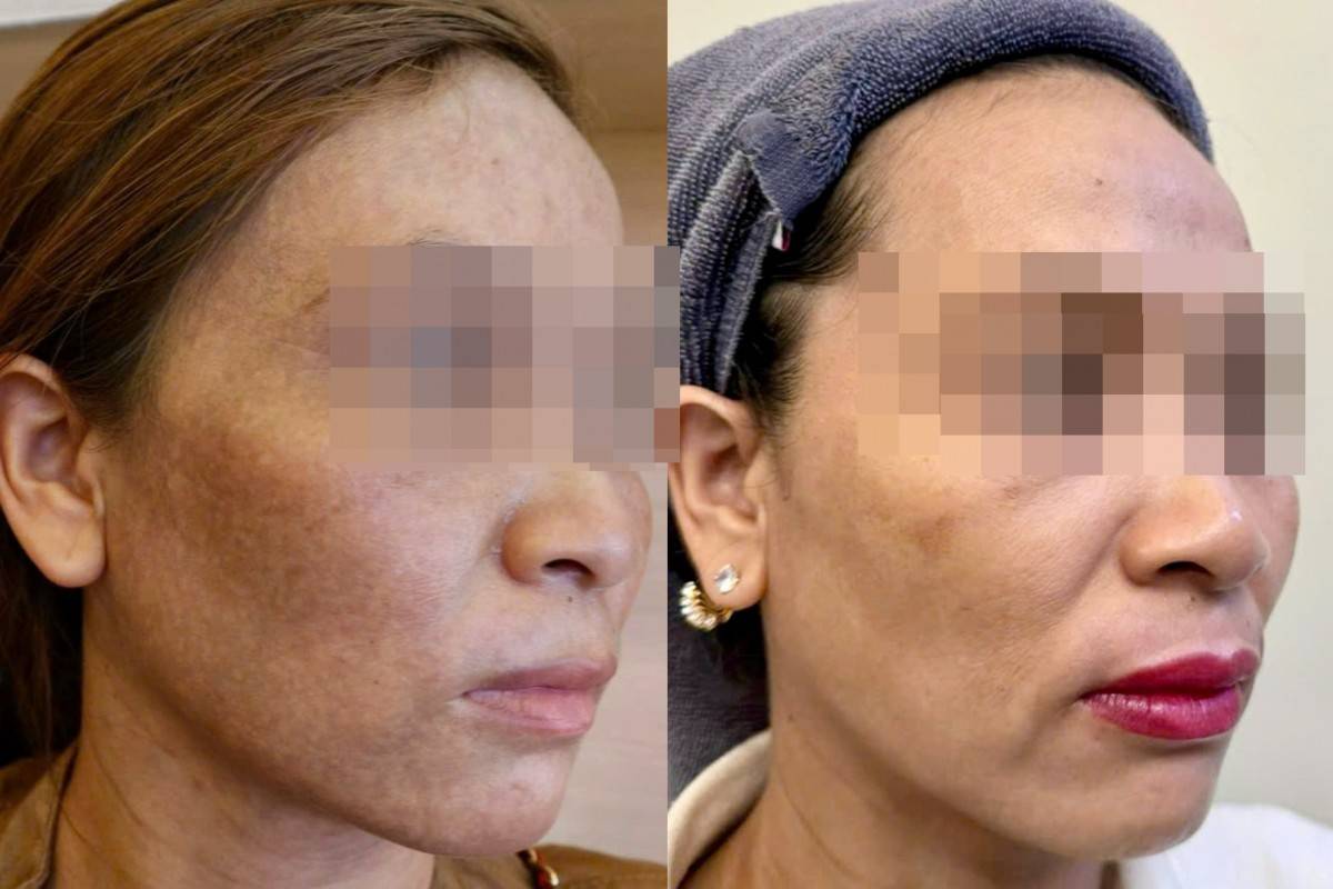 Hệ lụy khó lường khi sử dụng sản phẩm mỹ phẩm giả, kém chất lượng