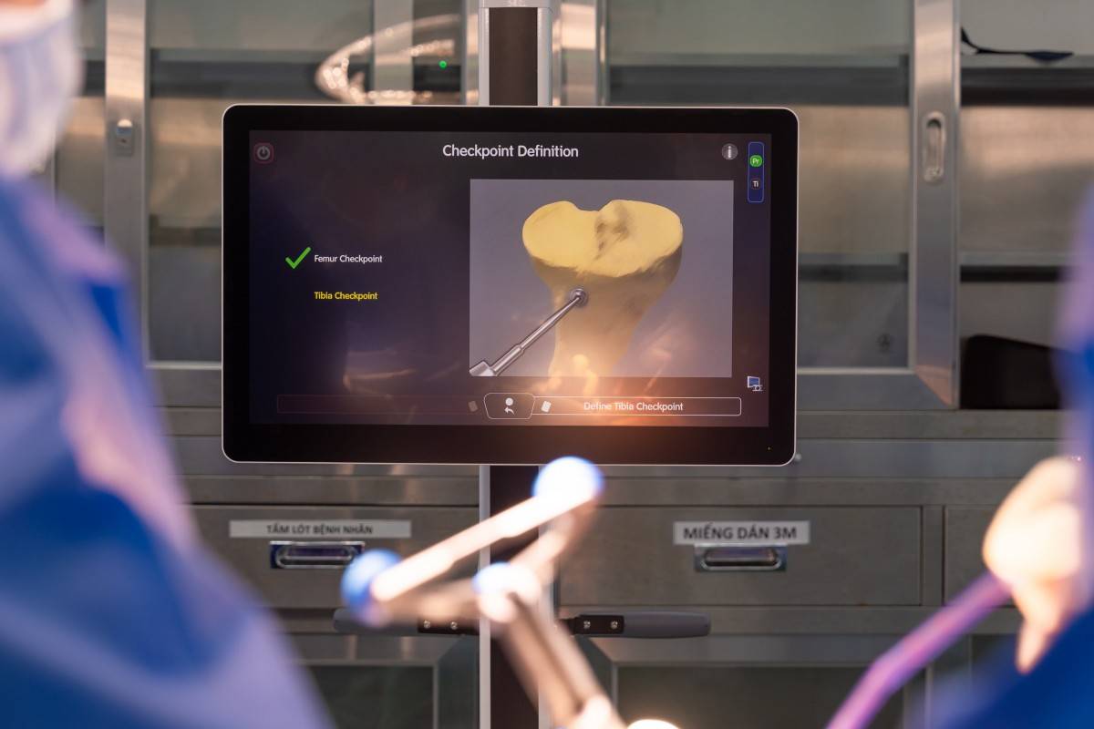  Robot CORI tích hợp trí tuệ nhân tạo AI đóng vai trò như “trợ lý” thông minh giúp bác sĩ thực hiện ca mổ đạt độ chính xác cao.