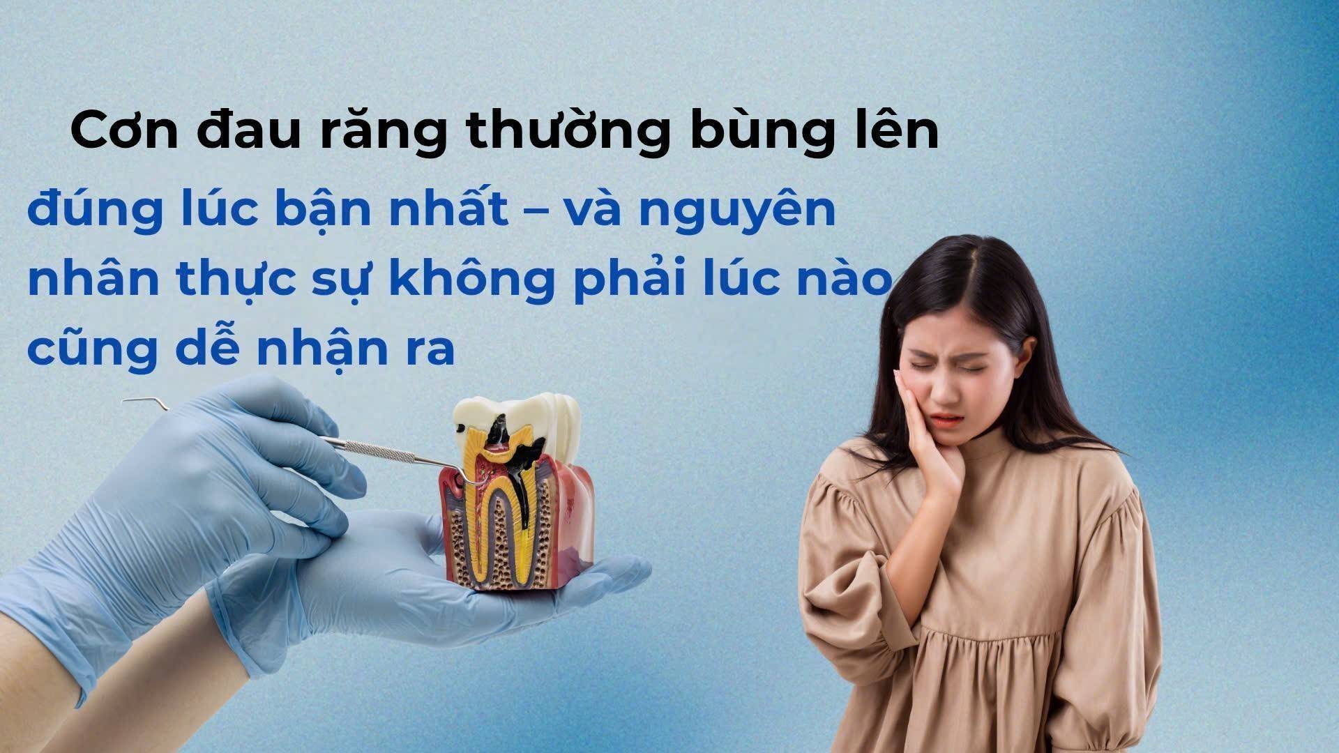 Đau răng là do gì? Bác sĩ chỉ 5 nguyên nhân thường gặp và cách giảm đau ngay