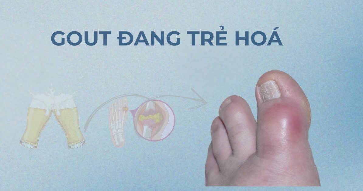 Vì sao gout ở nam giới trung niên ngày càng phổ biến và trẻ hóa?