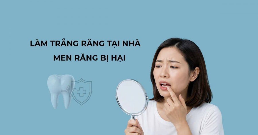 Làm trắng răng tại nhà: Vì sao men răng dễ bị tổn thương