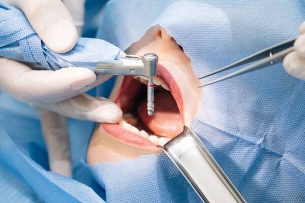 Cơ quan Cảnh sát điều tra Bộ Công an xác định: Hồ Ngọc Tiên Trung chỉ đạo quảng cáo gian dối về đội ngũ bác sỹ và nguồn gốc răng sứ cao cấp từ Mỹ, Đức, Nhật Bản để khách hàng tin tưởng thanh toán (Ảnh minh họa).