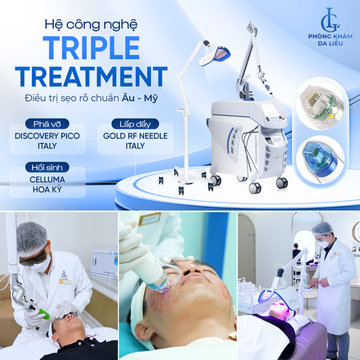 Bác sĩ ứng dụng ba công nghệ trong phác đồ trị sẹo rỗ đa tầng Triple Treatment