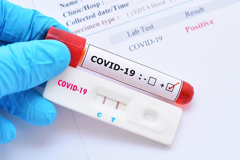 Nhiều test nhanh Covid-19 giảm gi&amp;aacute; 20.000 - 70.000 đồng/test